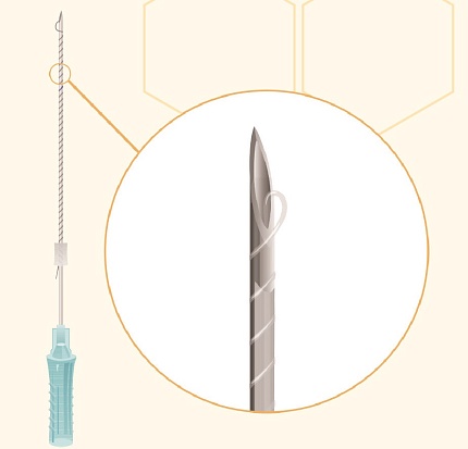SCREW (Normal Spiral)